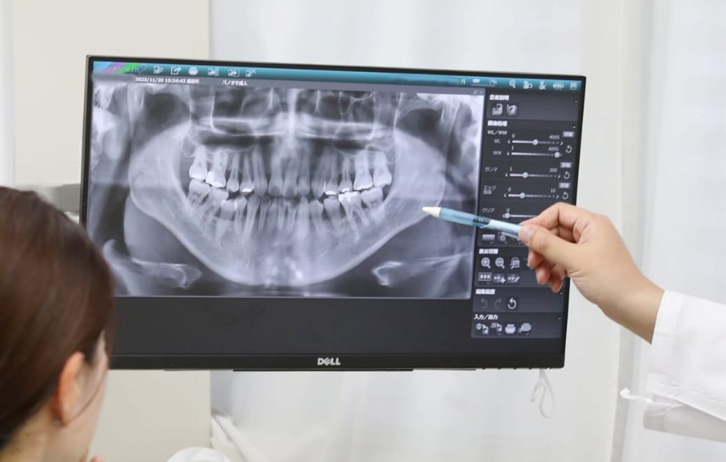 ¿Qué RX dental tienen?