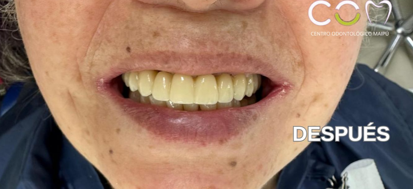 Título de la Sección