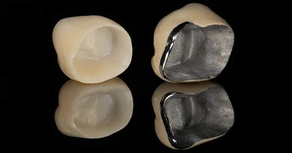 ¿De qué material son?