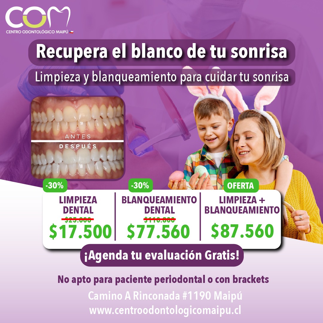Limpieza /Blanqueamiento Dental