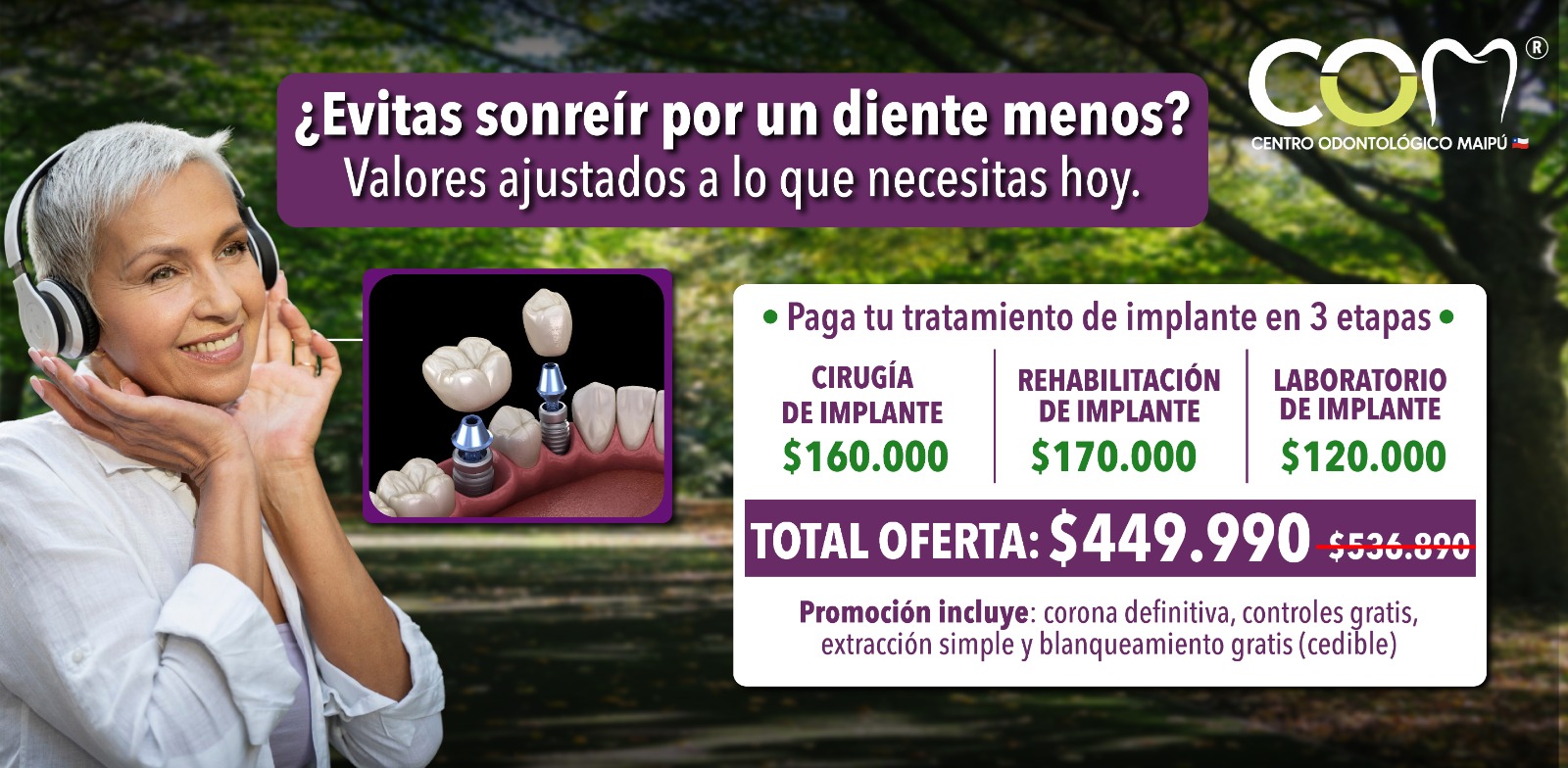 promocion implante dental