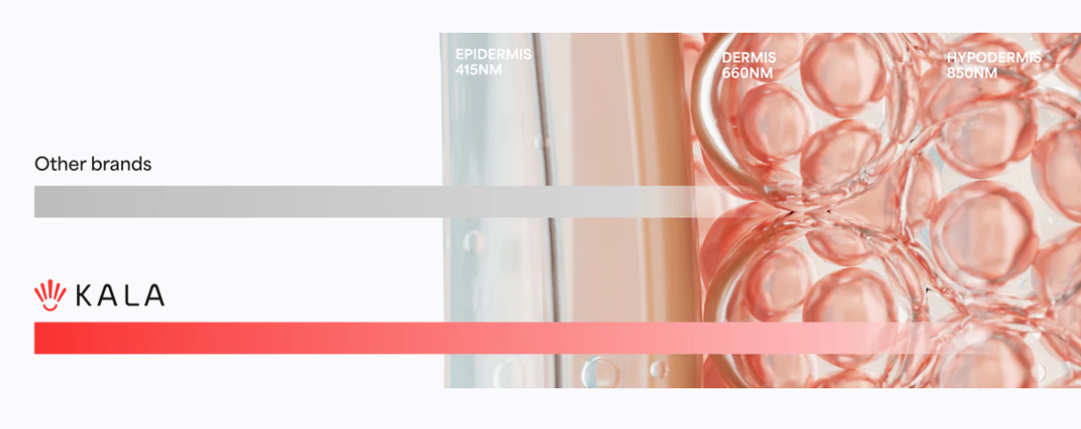 Tecnología Munum vs otras