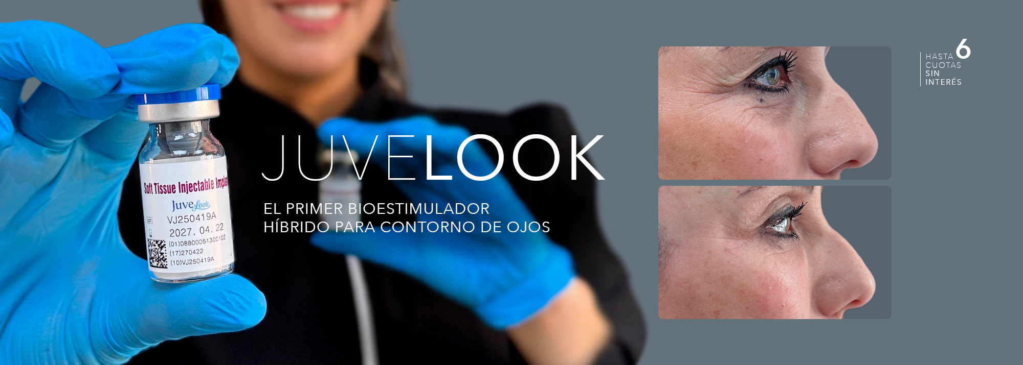 Promociones en tratamientos esteticos Clínica EM