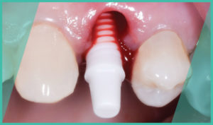 Estética sin igual