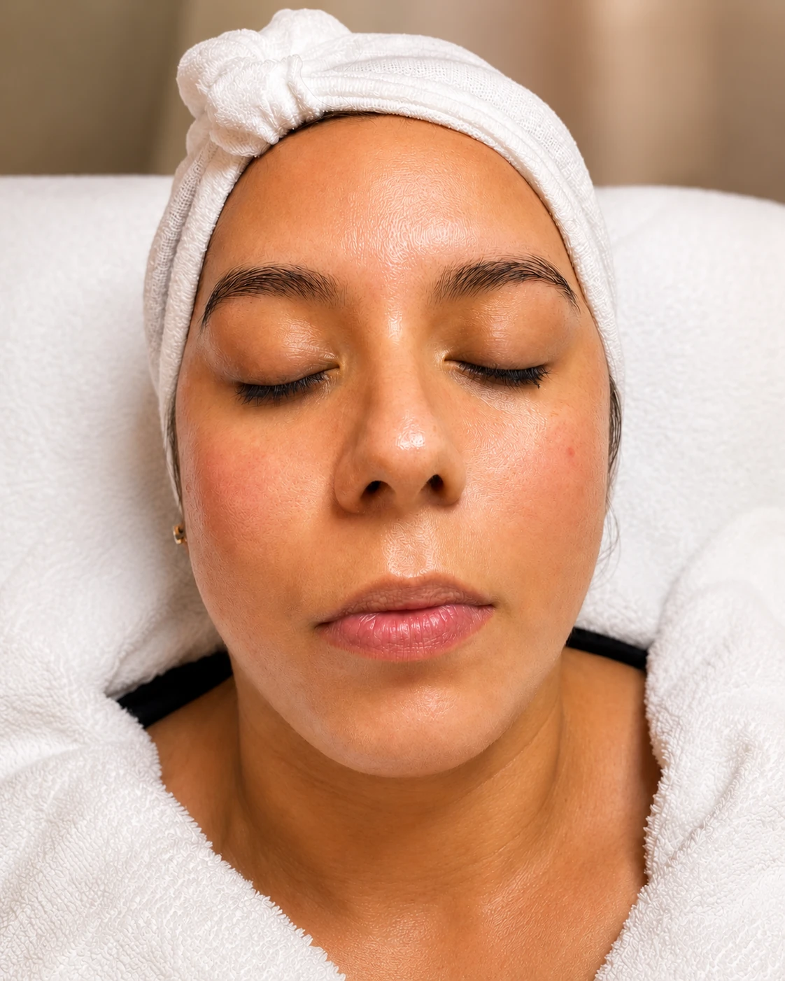 Ignacia durante su limpieza facial con Dermapen en Diana Beauty Studio