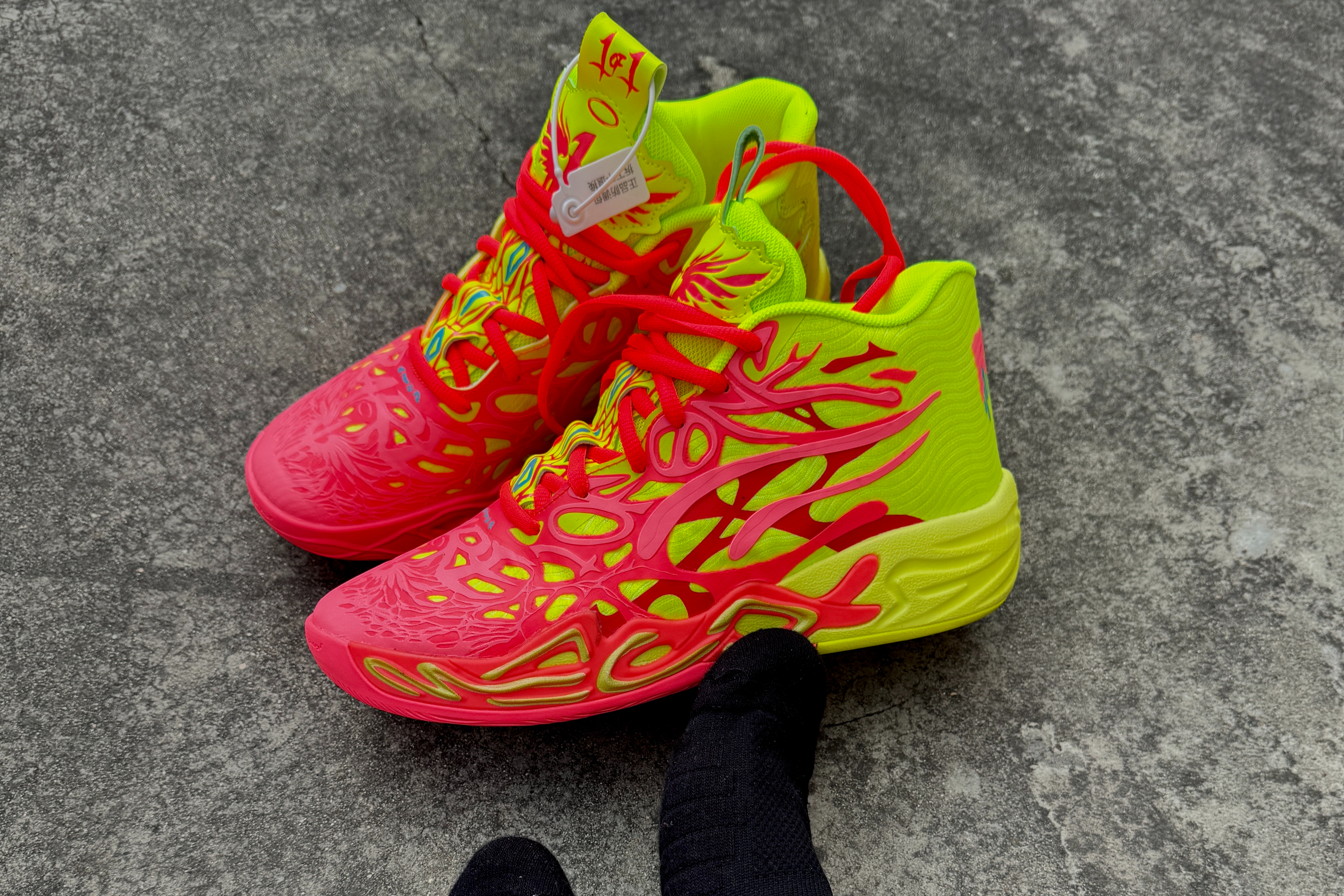 BALONCESTO
