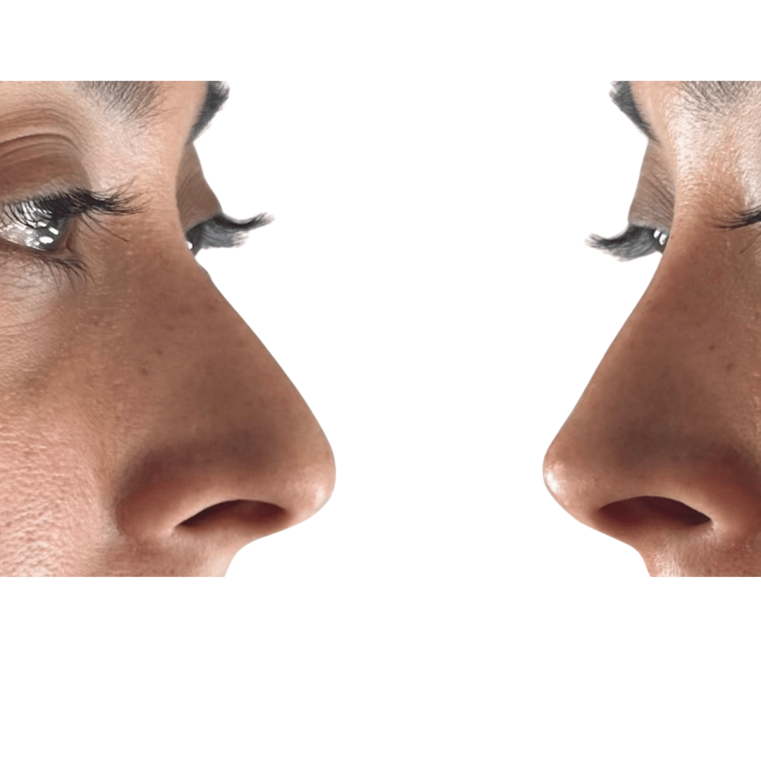 Testimonios reales de mis pacientes