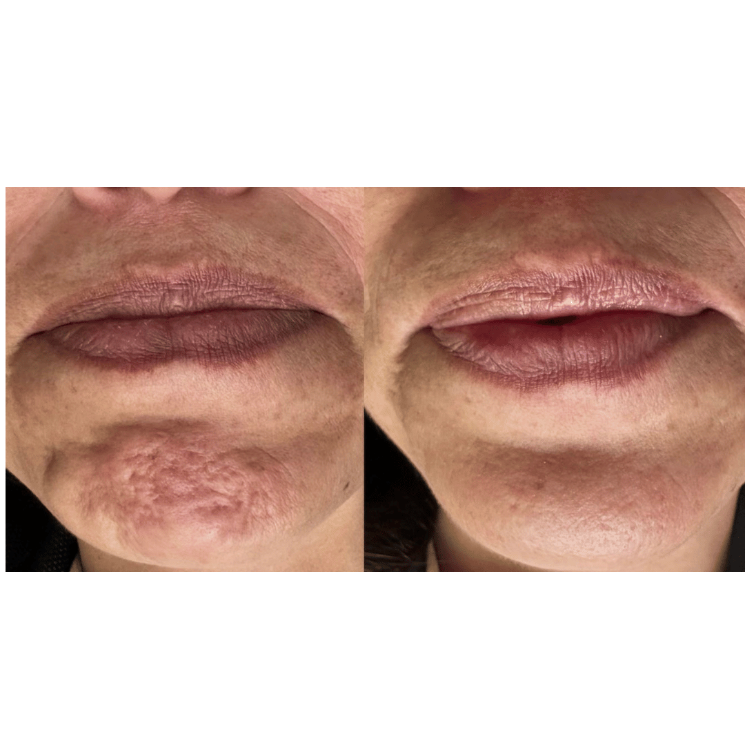 Testimonios reales de mis pacientes