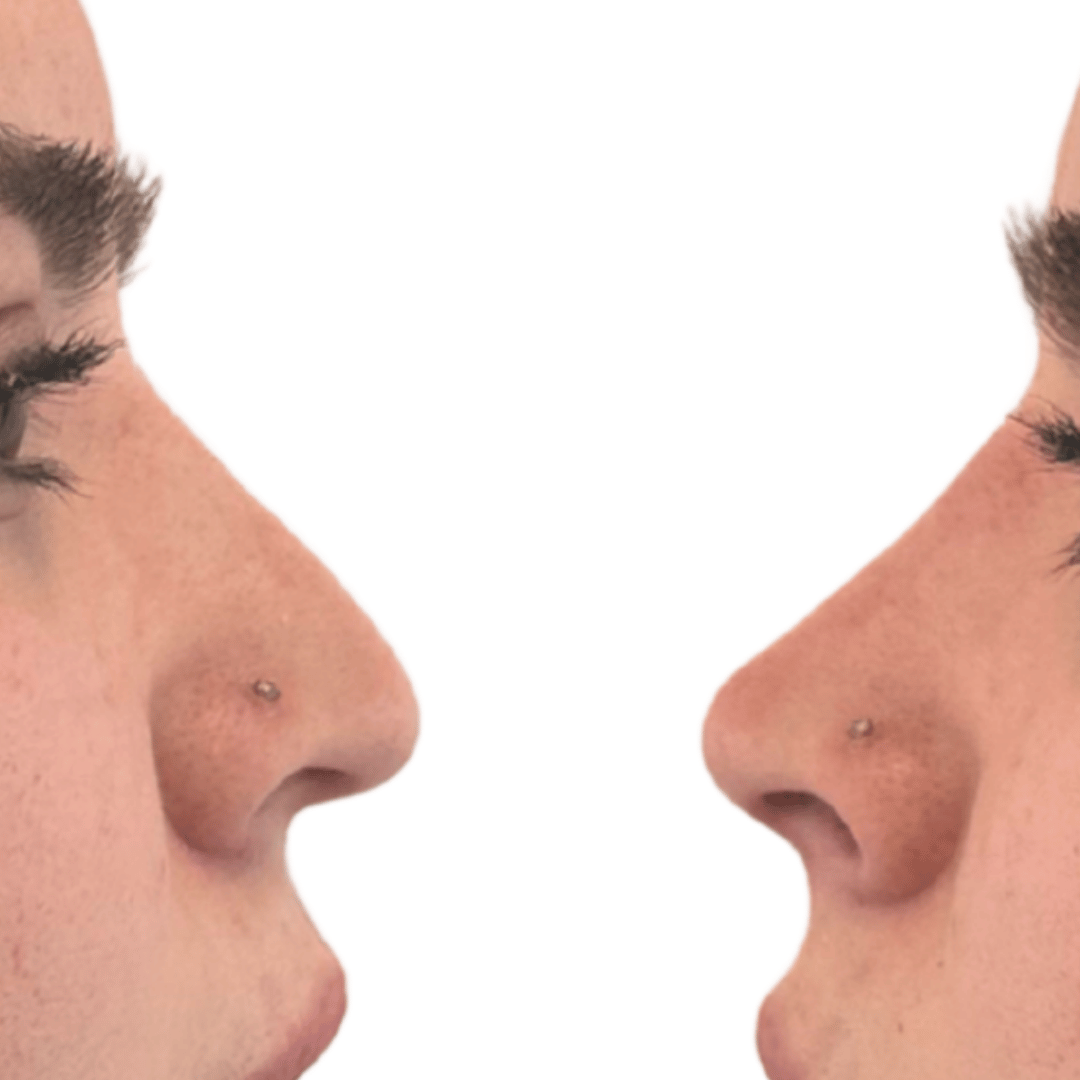 Testimonios reales de mis pacientes