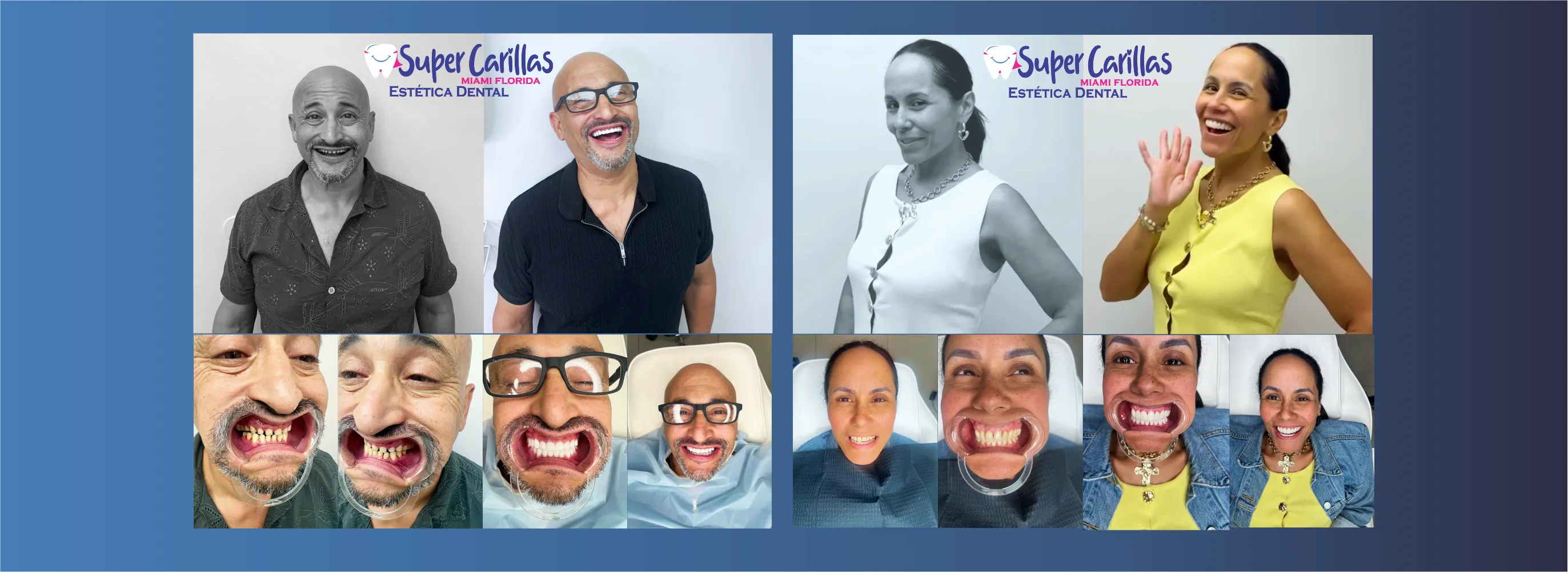 DISEÑO DE SONRISA MIAMI