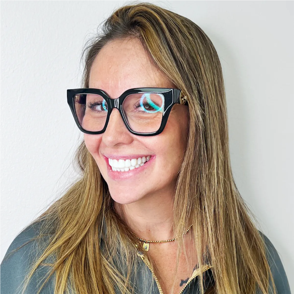 Antes y después de carillas dentales en Miami con SuperCarillas — transformación real de sonrisa: dientes manchados y desgastados antes, blancos y alineados después.