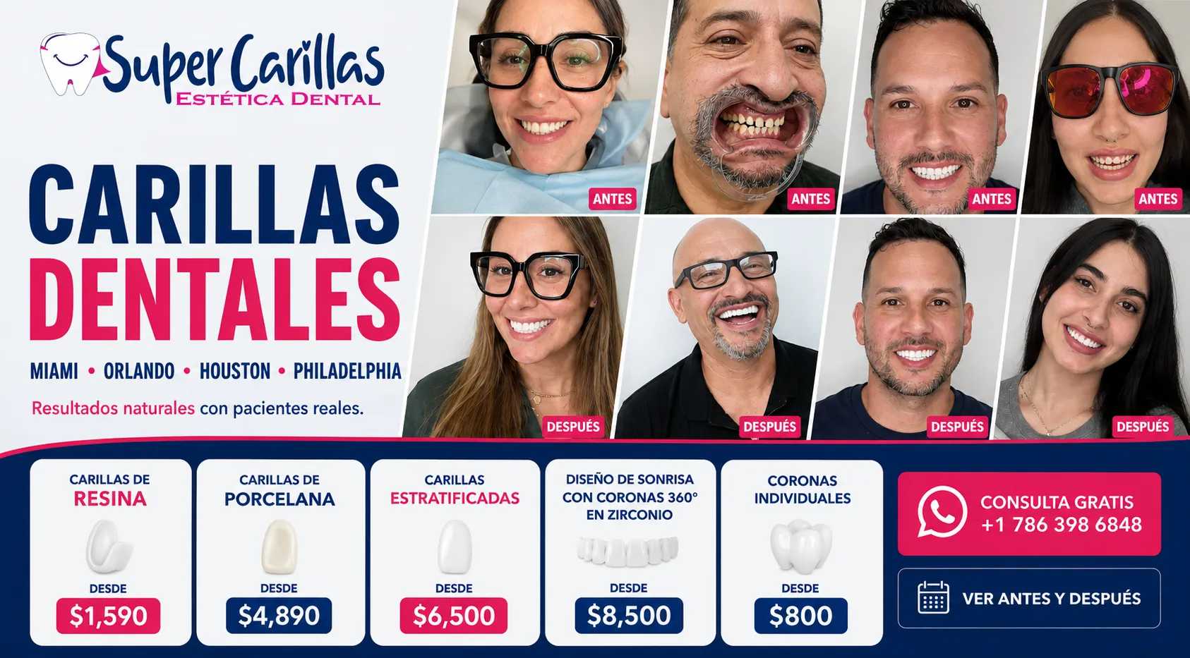Antes y después de carillas dentales en pacientes reales. Carillas de resina, porcelana y diseño de sonrisa en Miami, Orlando, Houston y Philadelphia por SuperCarillas Estética Dental
