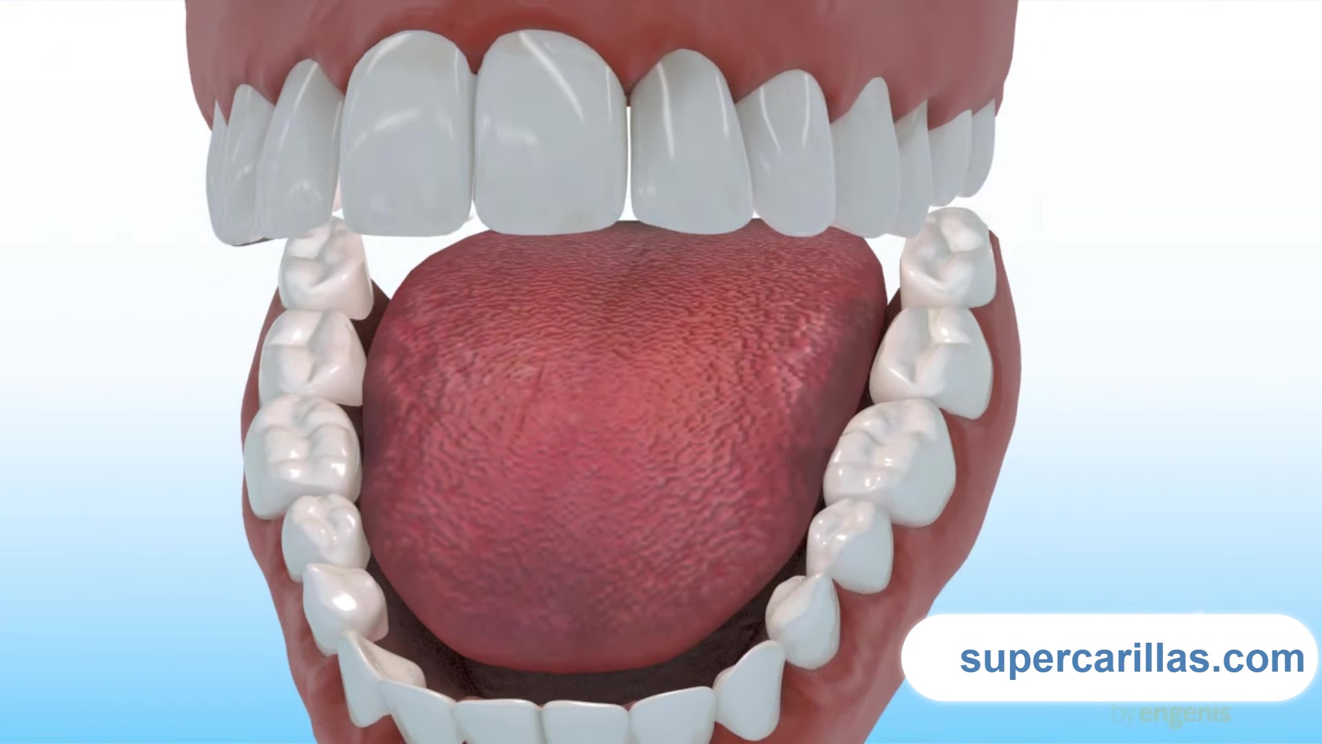 Ilustración del procedimiento de carillas en resina directa sobre dientes naturales