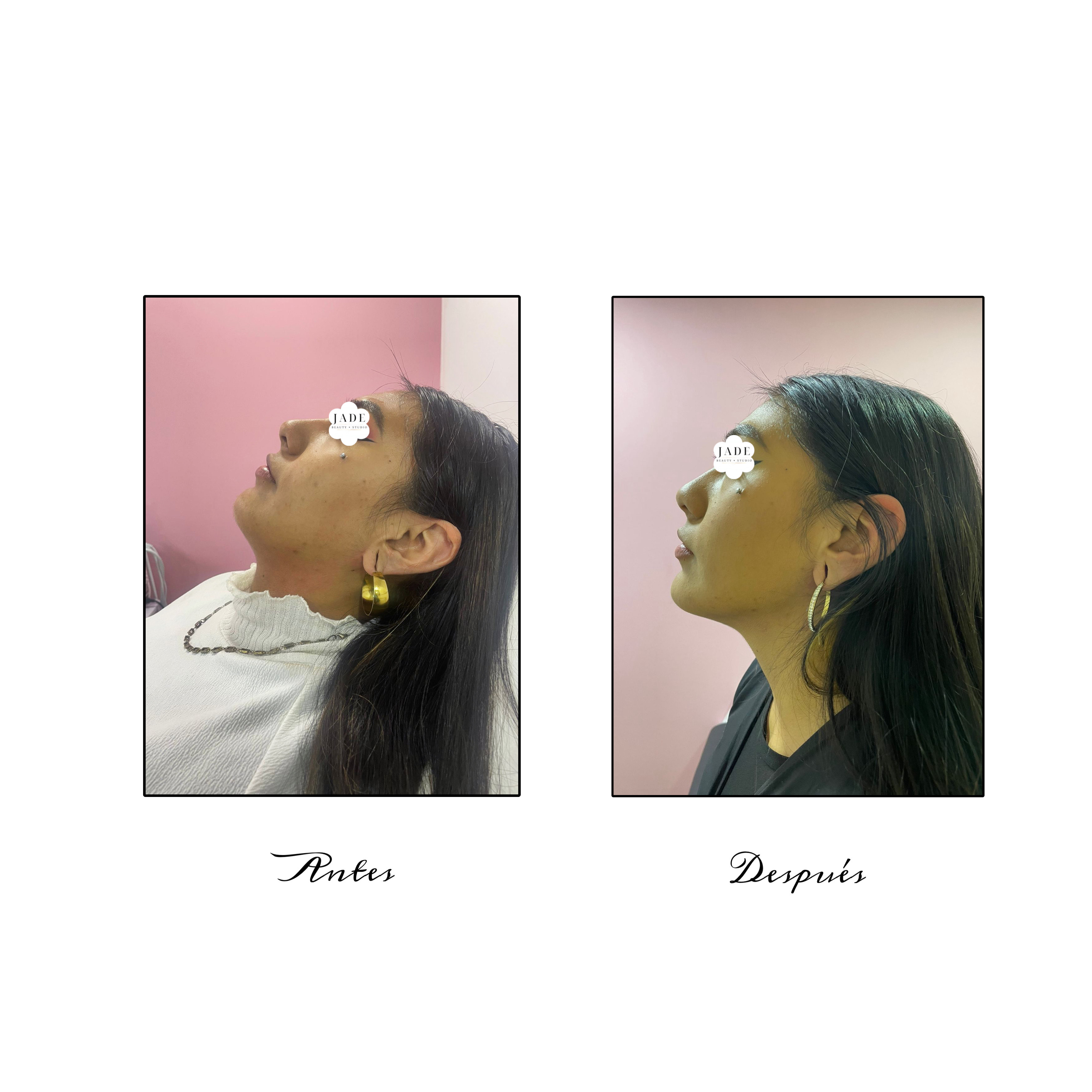 Lipopapada<br>