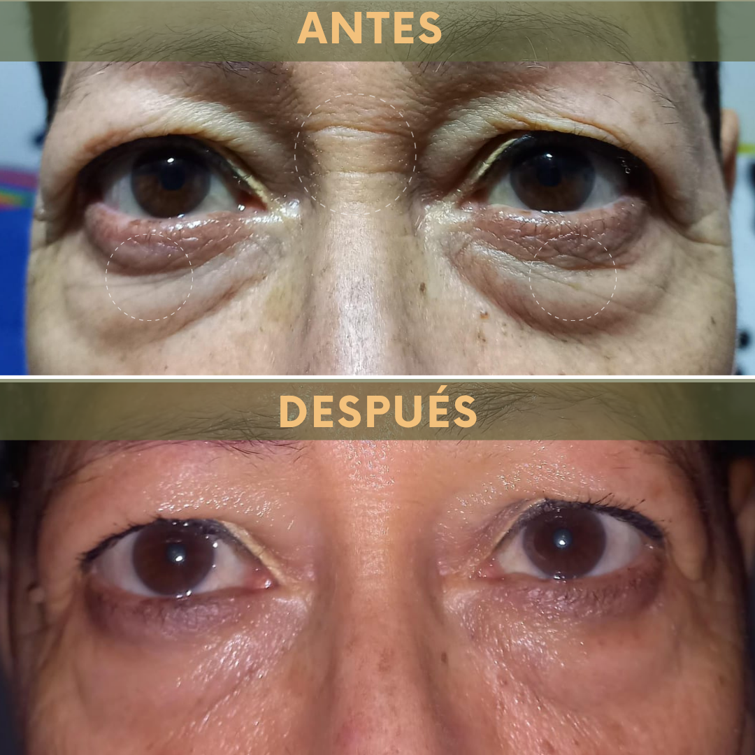 Rejuvenece tu mirada