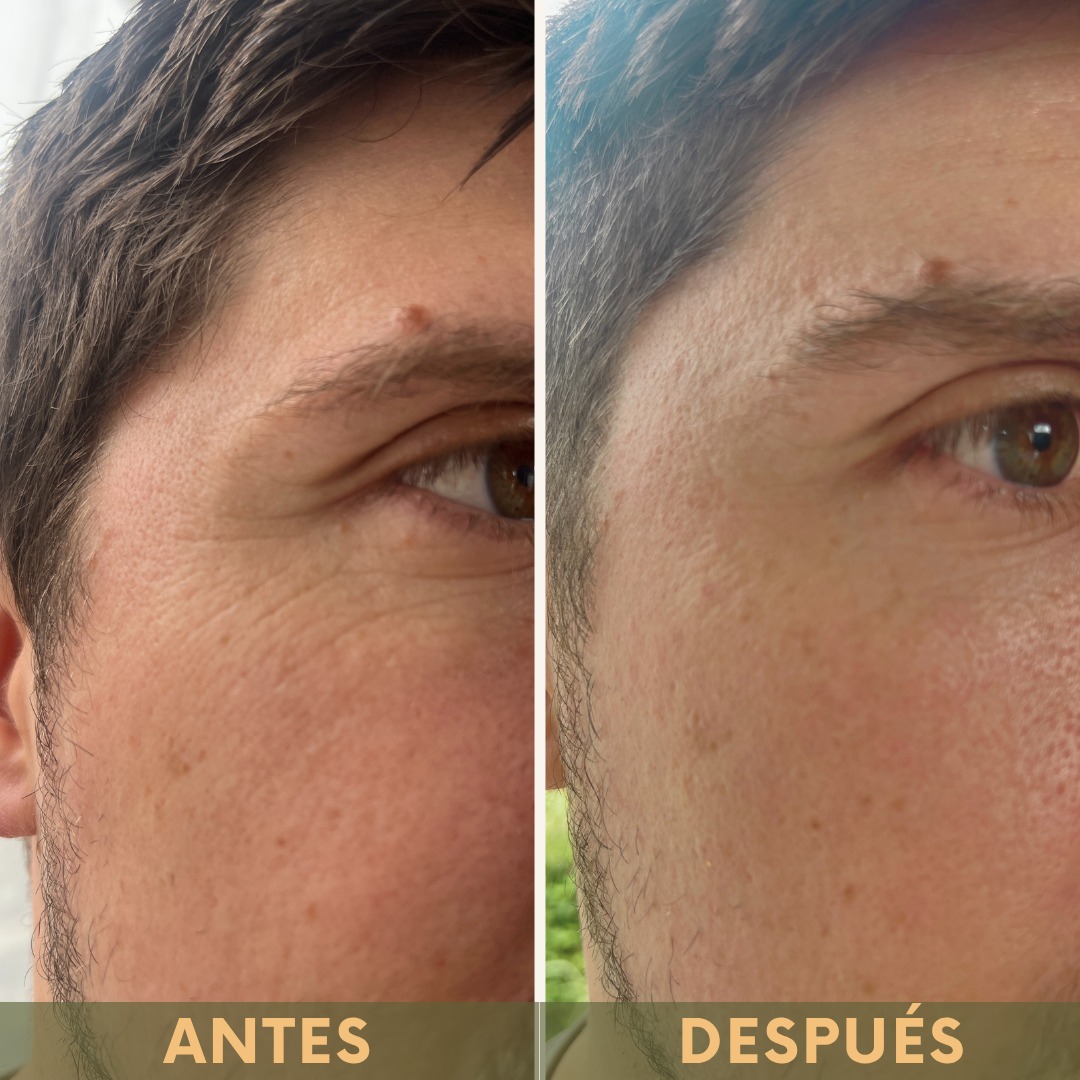 Rejuvenece tu mirada