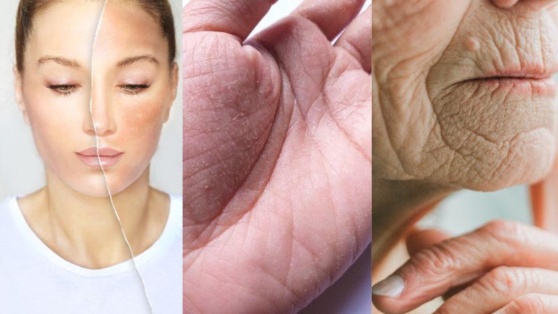 Pieles Sensibles, Dañadas o Debilitadas<br>