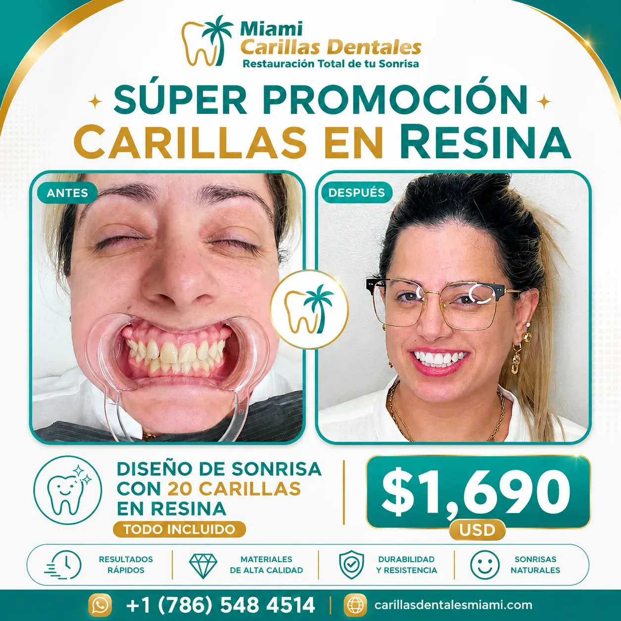 Promoción de Miami Carillas Dentales con diseño de sonrisa de 20 carillas en resina por $1,690 USD, todo incluido. Imágenes de antes y después, materiales de alta calidad y atención por WhatsApp en Miami