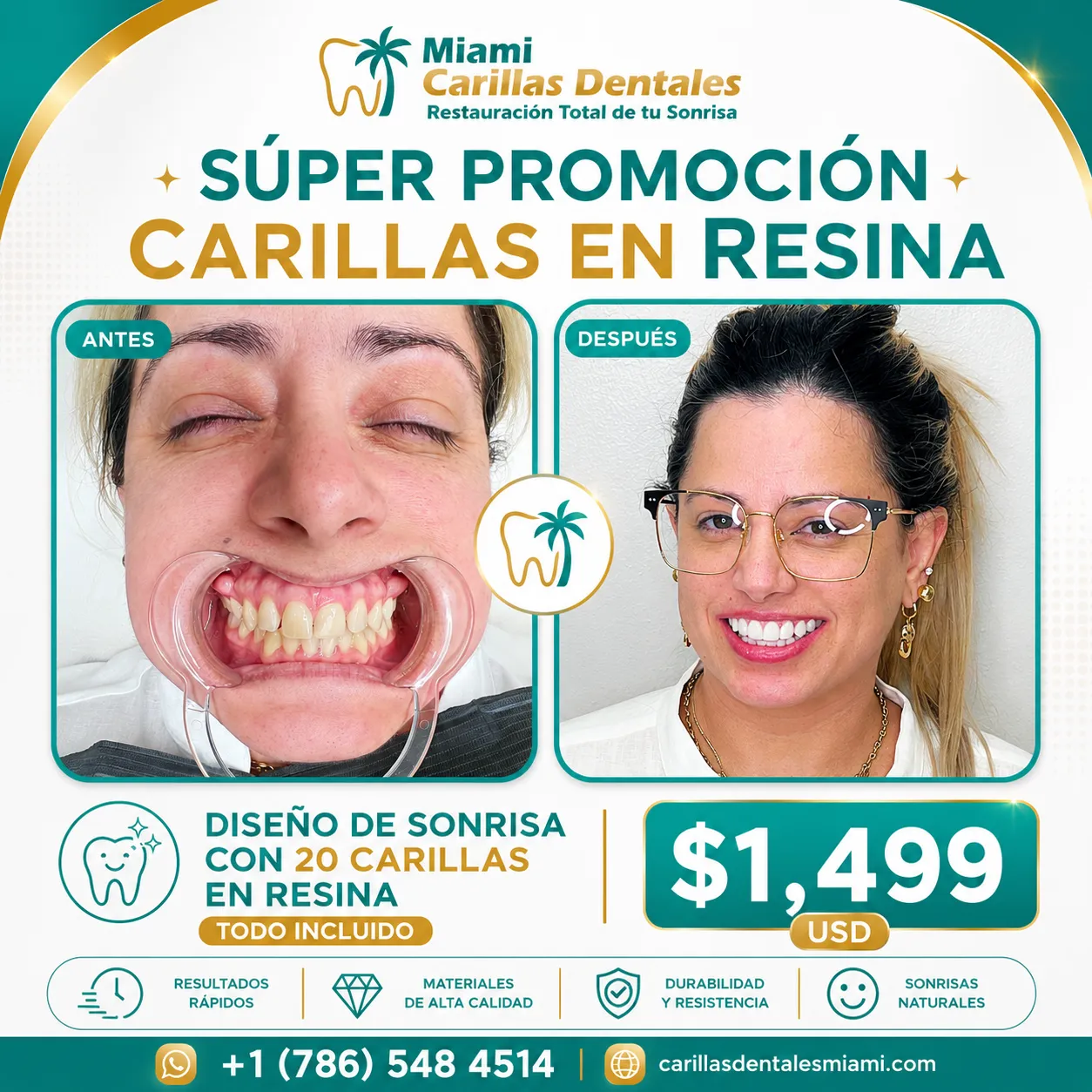 carillas en resina miami $1,499