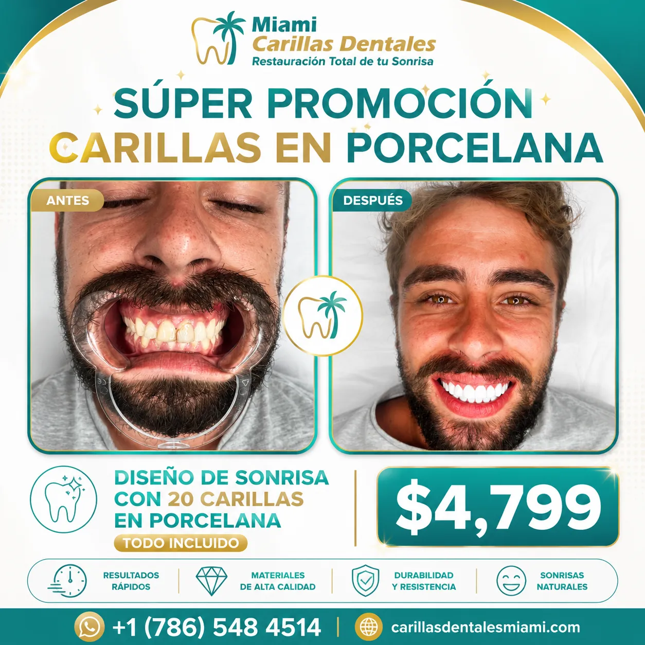 carillas en porcelana miami $4,799