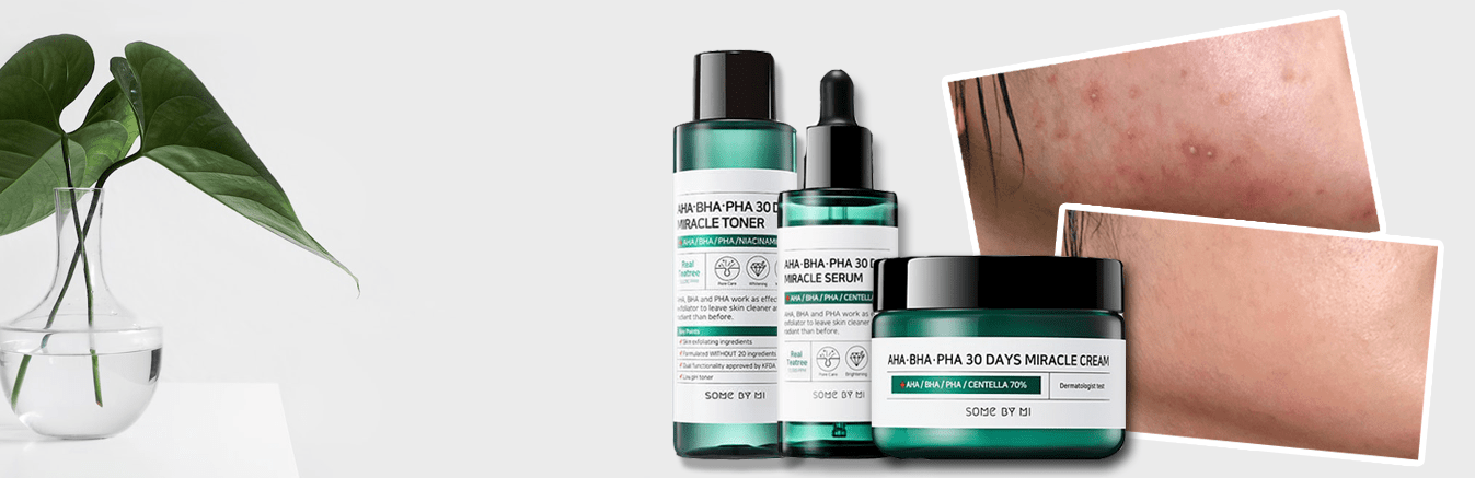 ¡Milagro en tu piel en 30 días!