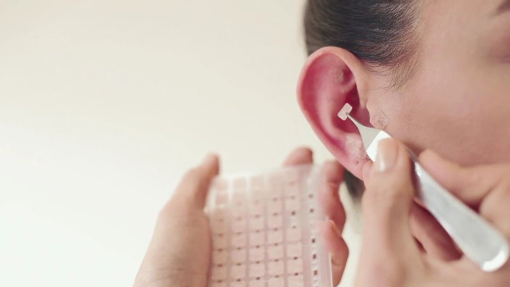 Insumos para Auriculoterapia