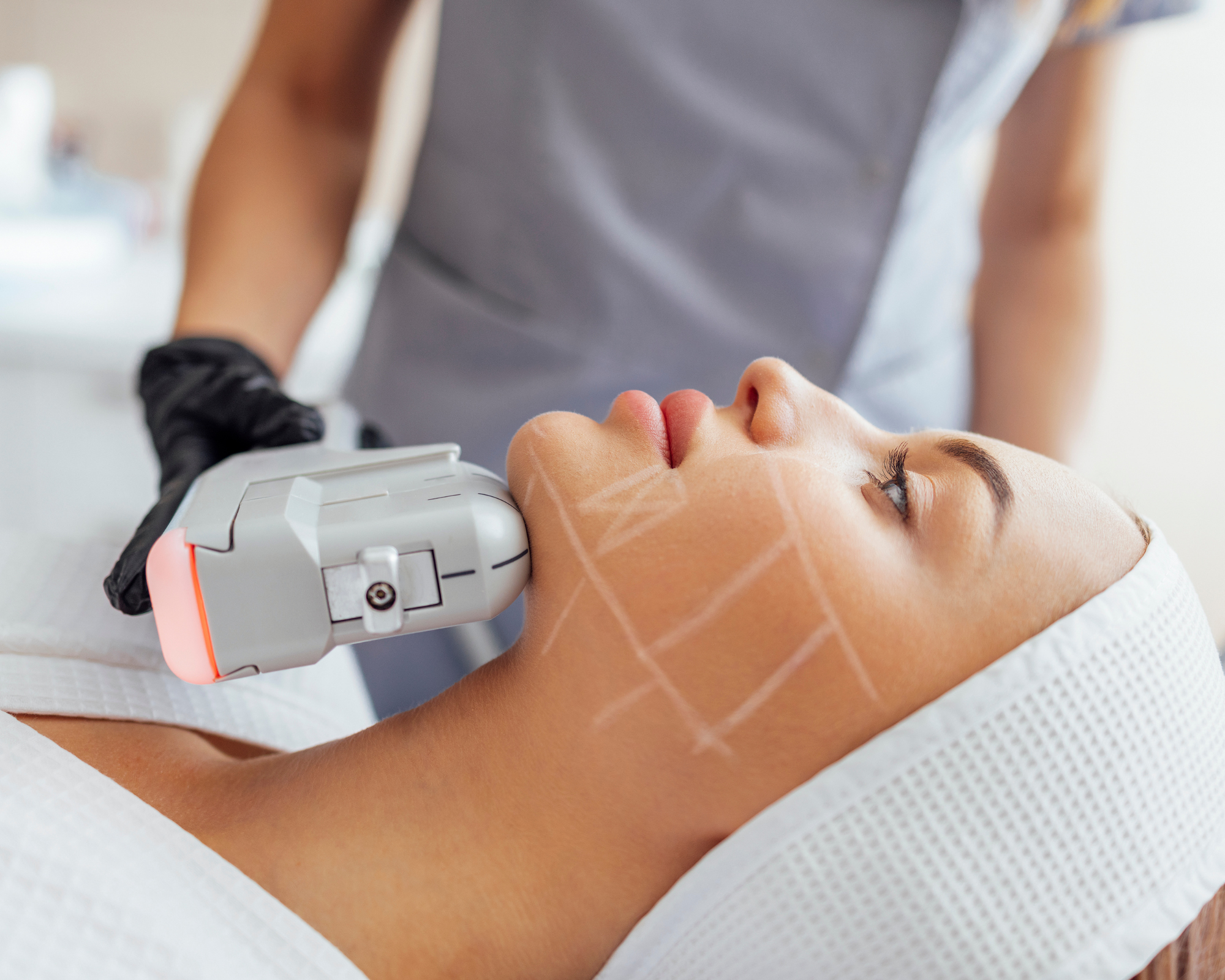 Formação em HIFU - Ultrassons Micro e Macrofocados