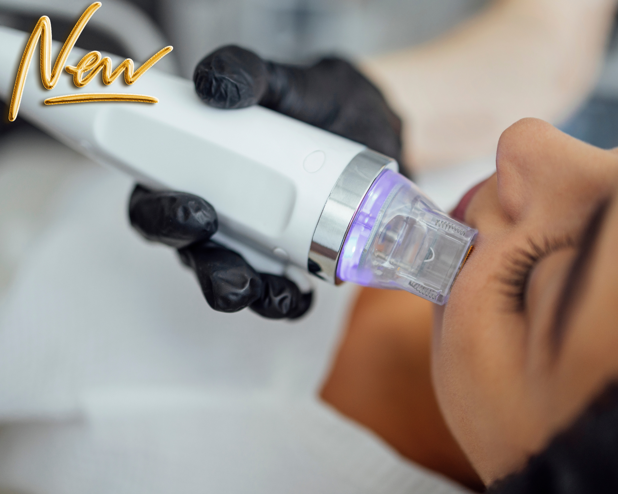 Formação em Indução de Colagénio por Derma Pen e RF Fracionada