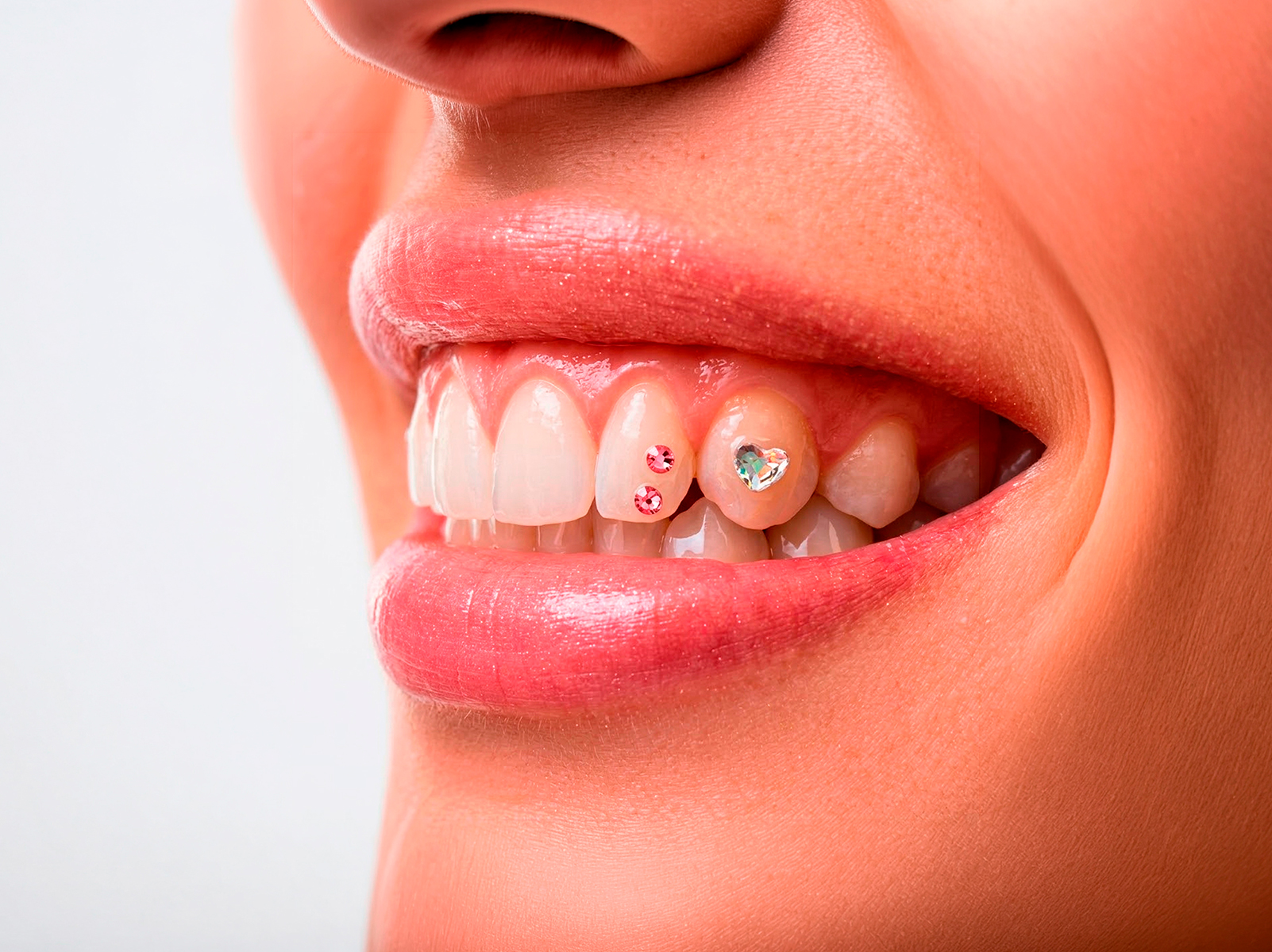 Joyería Dental Exclusiva